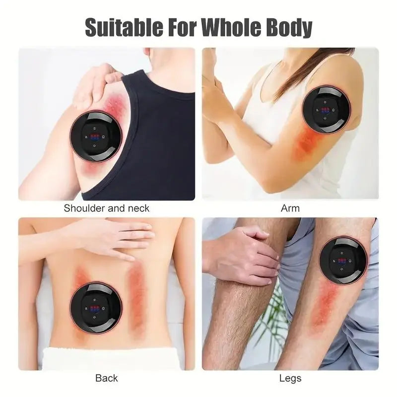 Smart Vacuum Cupping Massager